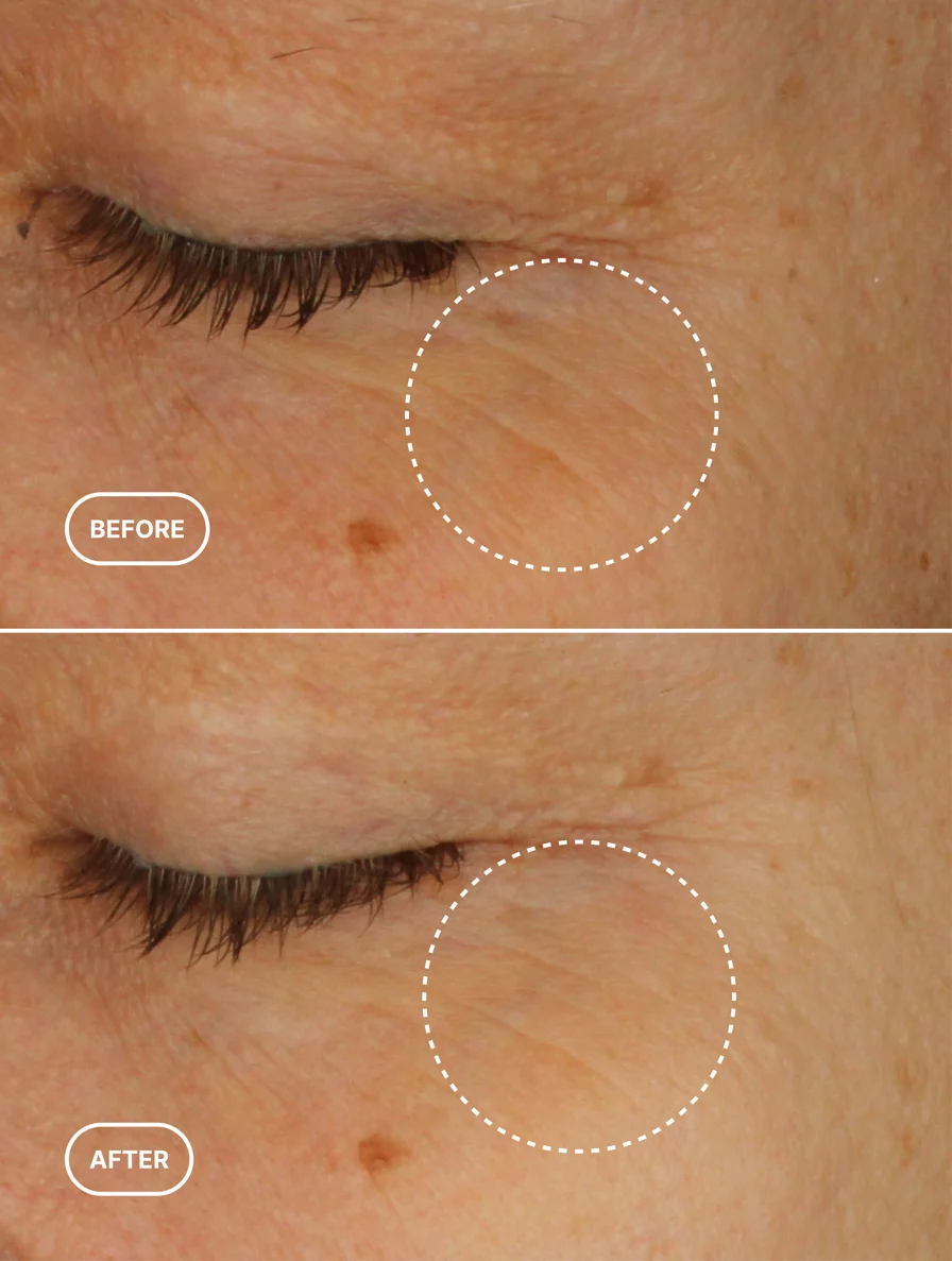 Retinol Alternative eye serum