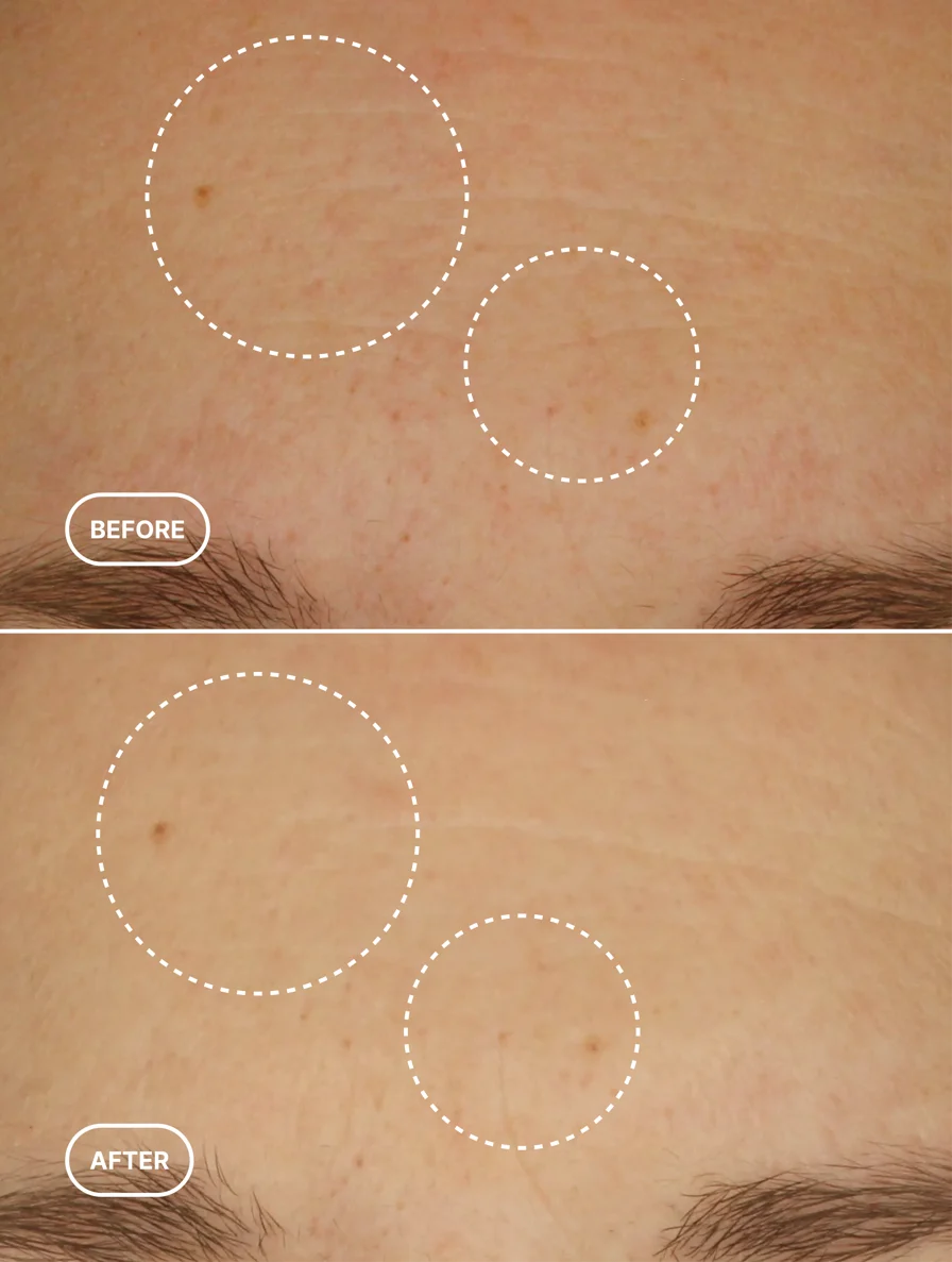 Retinol Alternative Age-Defying Serum - dawody-science-fashion