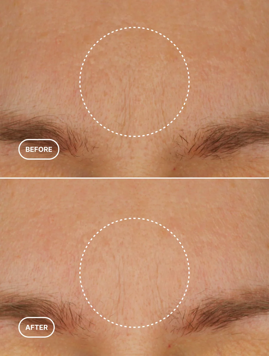 Retinol Alternative Age-Defying Moisturizer - dawody-science-fashion